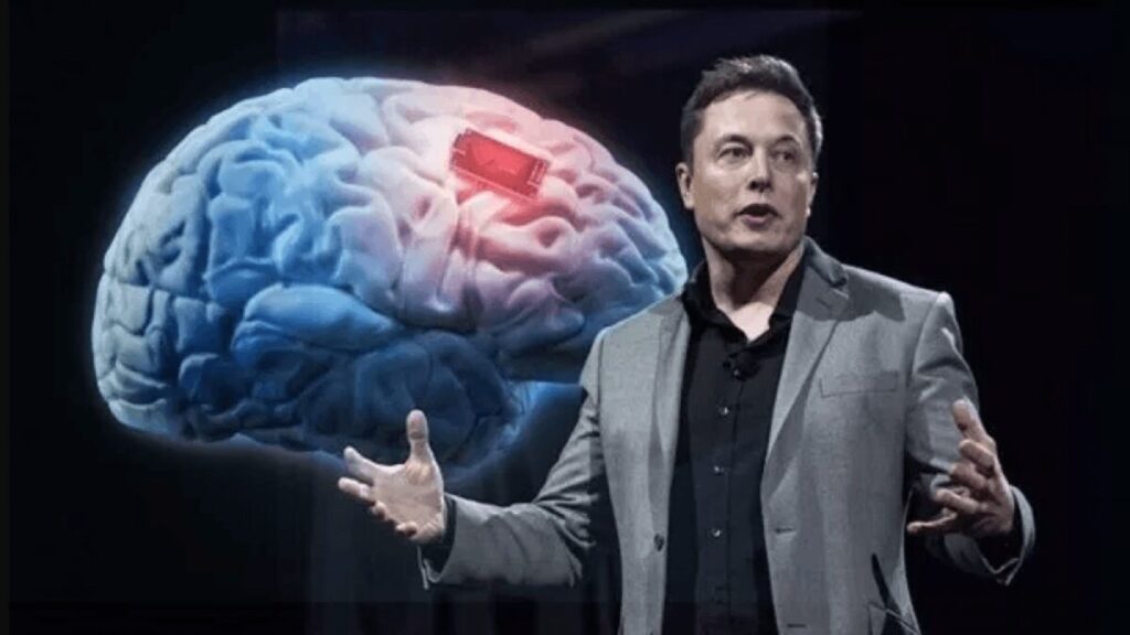 Elon-Musk-primo-microchip-cervello-umano-impiantato-1024x576 Microchip di Elon Musk impiantato in un cervello umano