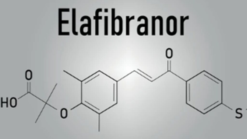 elafibranor-1024x576 Malattie epatobiliari rare: i risultati sull’efficacia di elafibranor